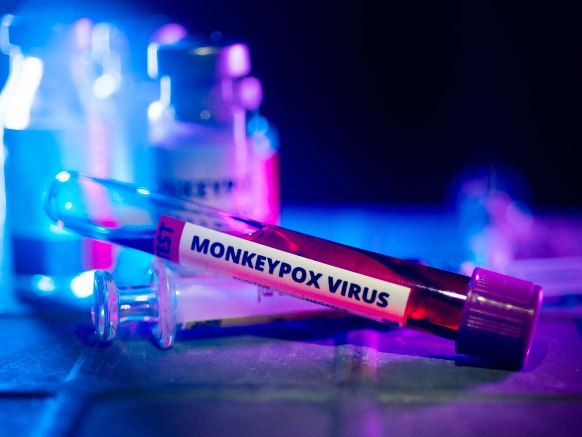 Viruela del mono o mpox: ¿puede convertirse en una pandemia?