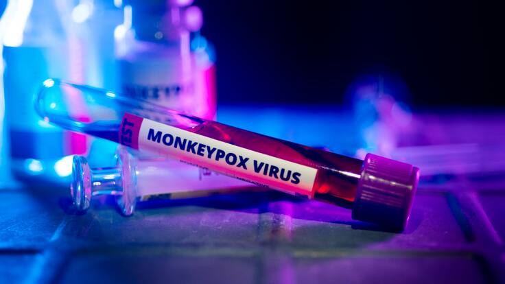 Viruela del mono o mpox: ¿puede convertirse en una pandemia?