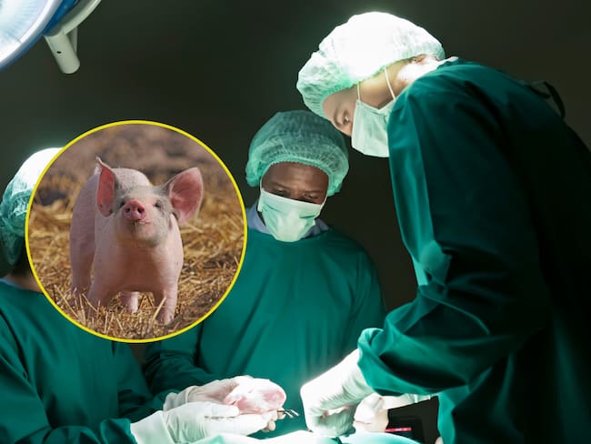 ¿Por qué se puede trasplantar el riñón de un cerdo en humanos? Nuevo caso de éxito