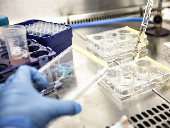 Esperanza para el mundo: vacuna contra el VIH entra en fase tres de ensayos