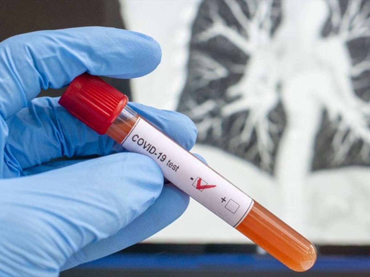 Autoridades en Córdoba confirman primer fallecimiento por COVID-19 en Montería