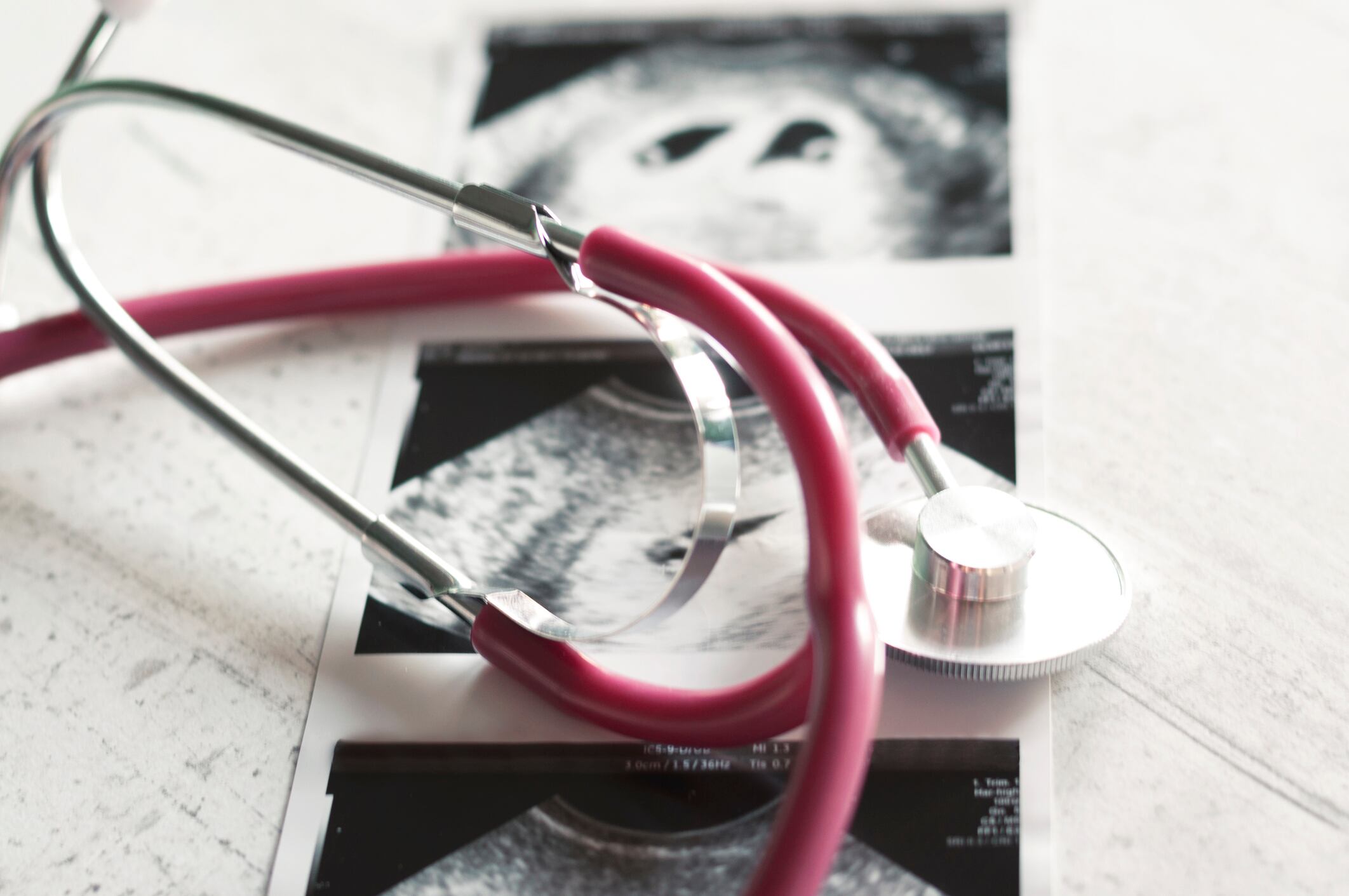 Interrupción voluntaria del embarazo