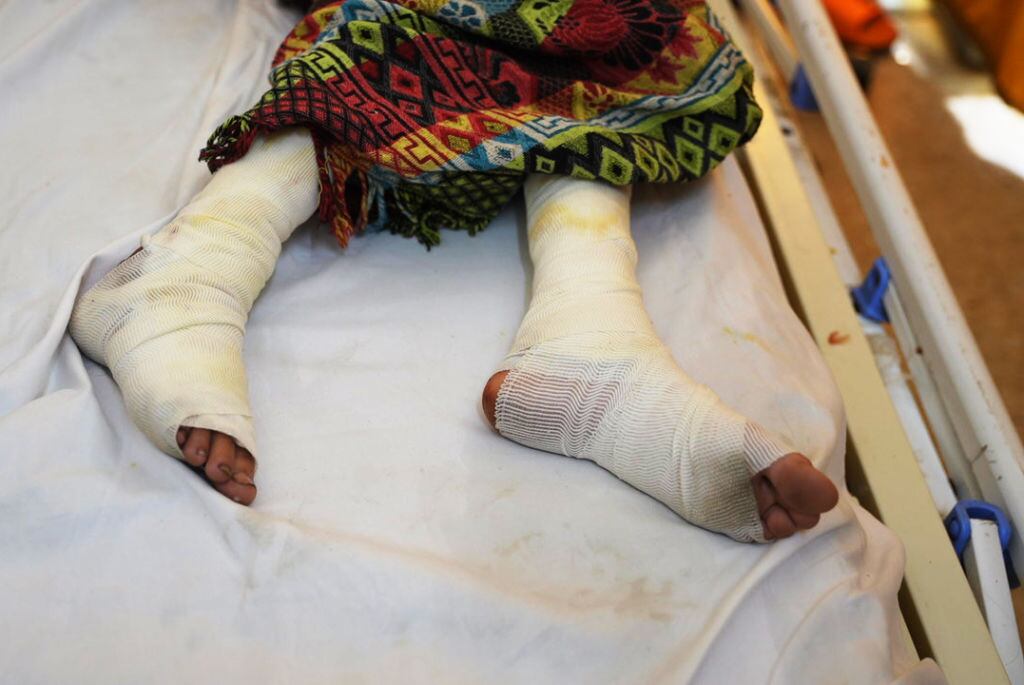 Persona quemada. I Foto: Anas Zeyad Fteha/Anadolu via Getty Images.