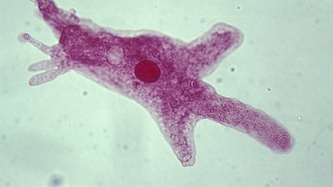 Se trata de Naegleria fowleri, un organismo unicelular que se encuentra en los ríos y lagos contaminados.. Foto: Getty Images