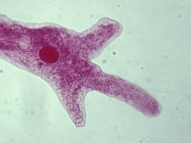 Se trata de Naegleria fowleri, un organismo unicelular que se encuentra en los ríos y lagos contaminados.. Foto: Getty Images