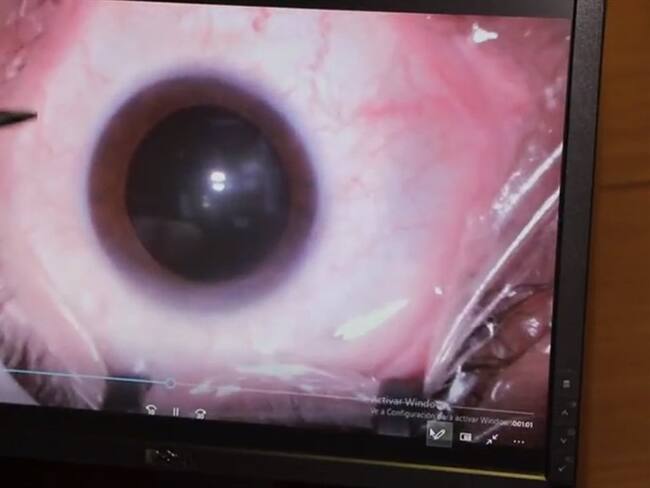 Terapia Antiangiogénica.