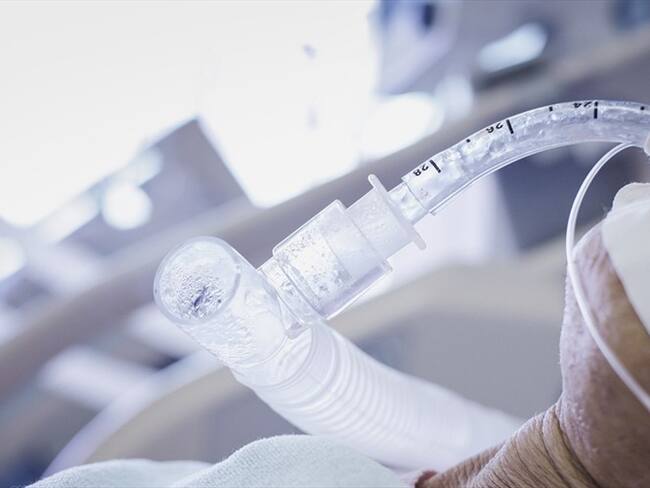 ¿Cómo va a conseguir Colombia los respiradores que le hacen falta?