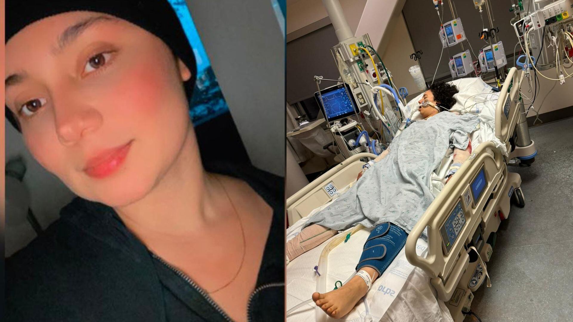 Santandereana fue ataca por perros en USA y familia pide ayuda para viajar a cuidarla. Fotos: Suministradas a W Radio.