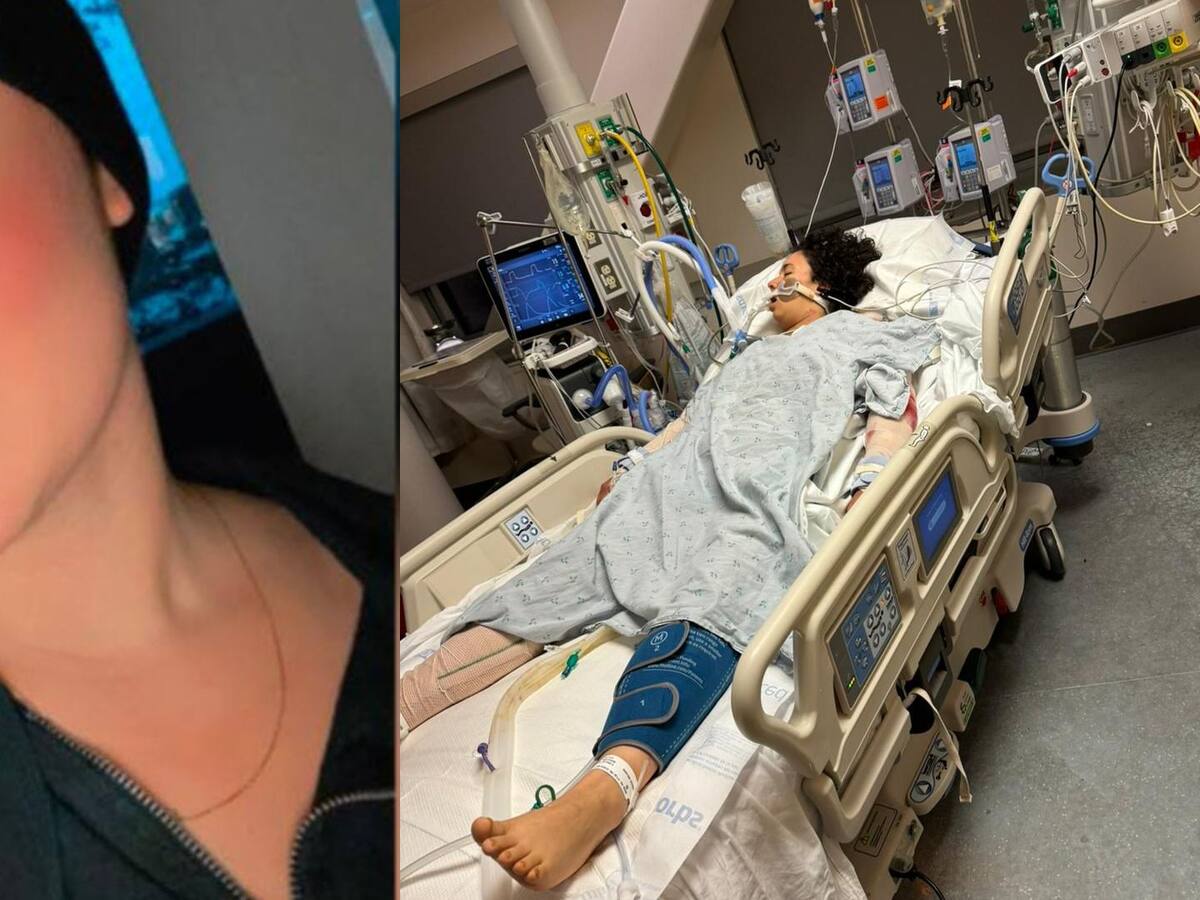 Santandereana fue atacada por perros en USA y familia pide ayuda para viajar a cuidarla
