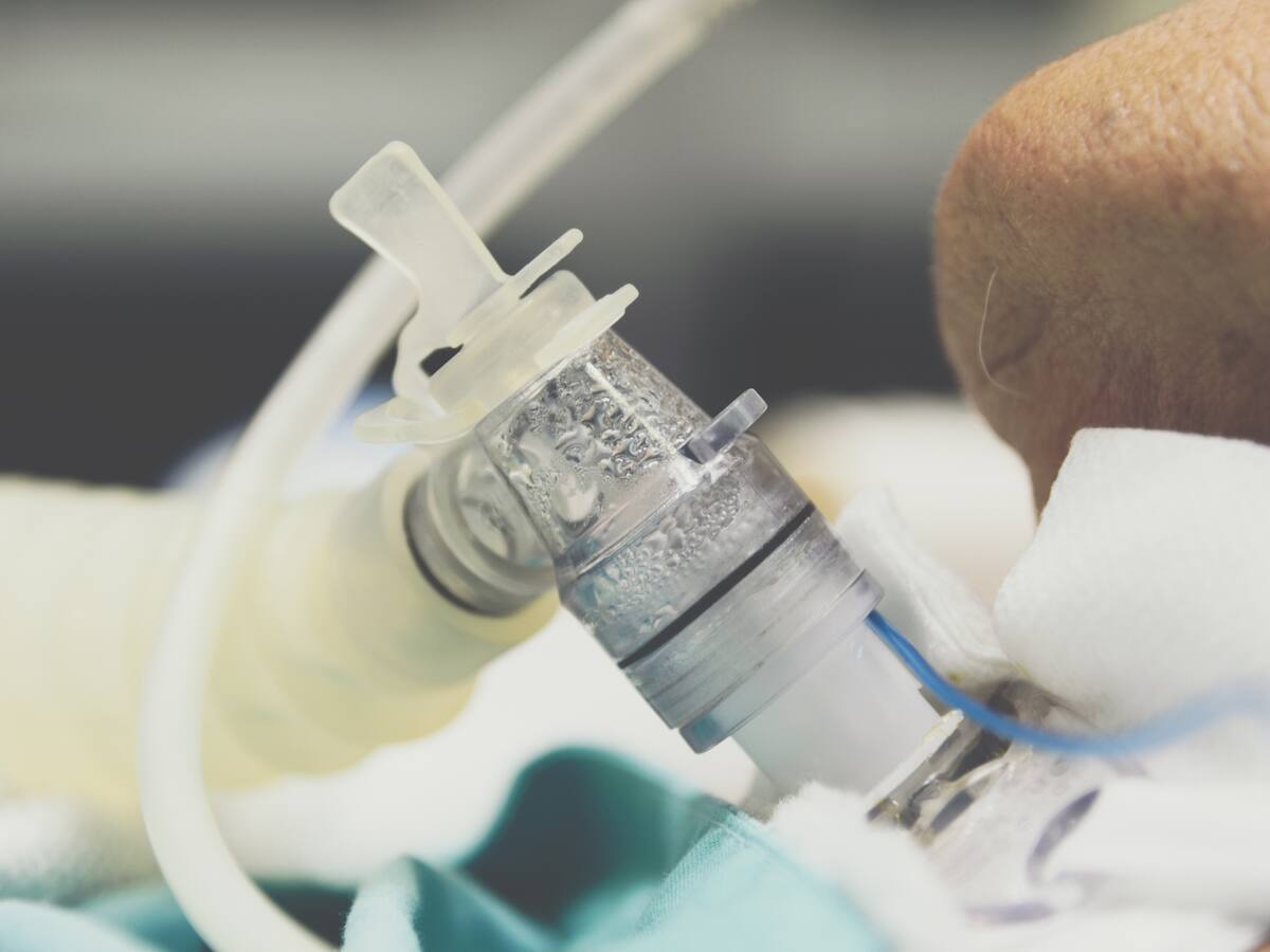 ¿Cómo se realiza la traqueostomía y qué beneficios trae? Experta explica