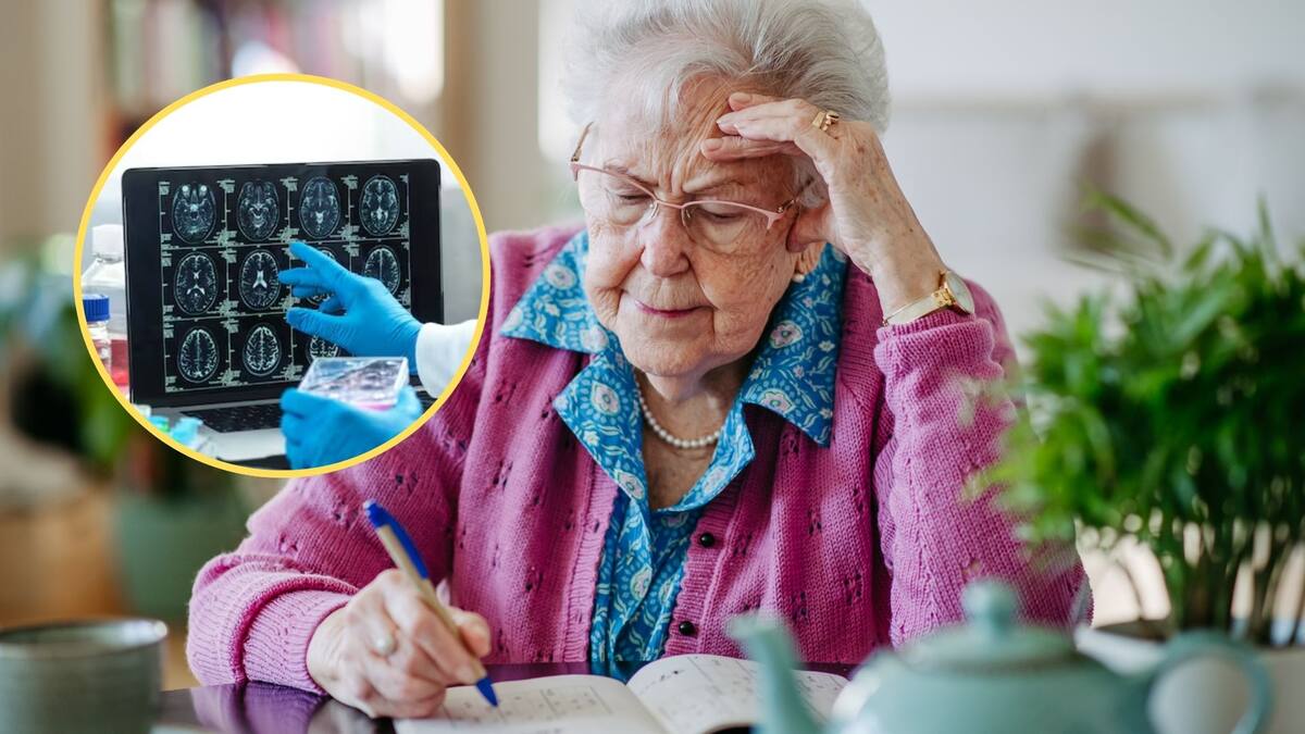 Con un simple pinchazo en el dedo: Xavier Morató explicó el avance para detectar el Alzheimer