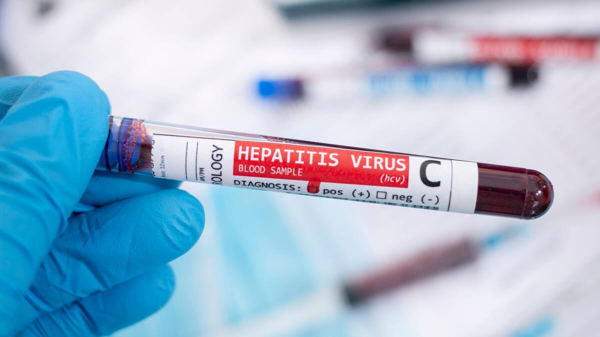 ¿Hepatitis aguda en Colombia? Esto es lo que se conoce