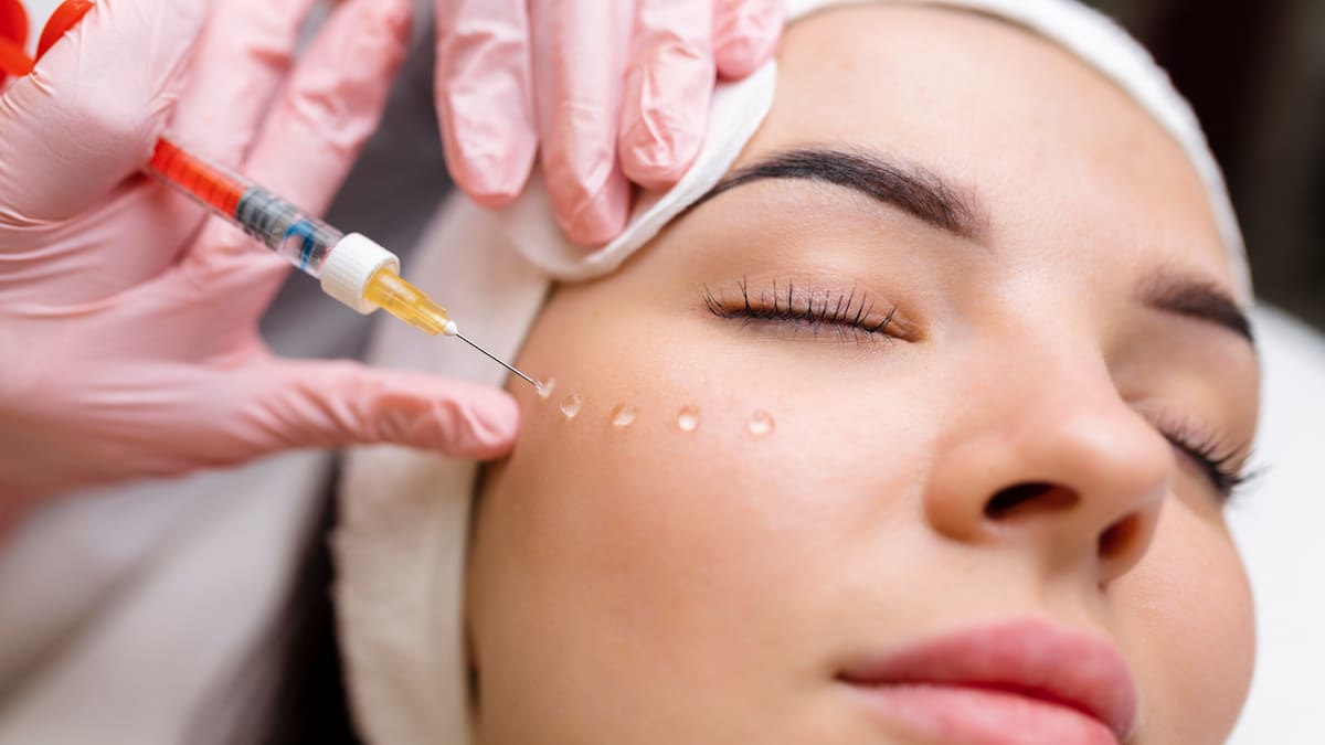 ¿Qué es la bioestimulación? Doctorá explicó de este procedimiento estético que recupera el colageno