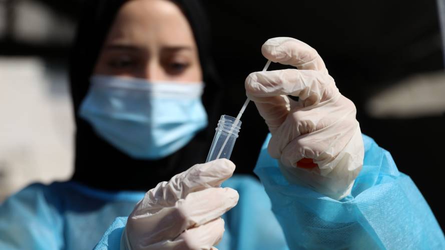 Covid 19 test. Créditos: Getty Images