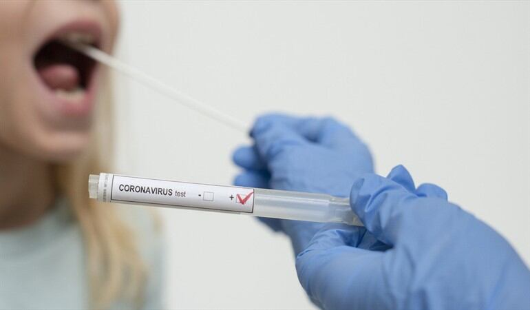 Imagen de referencia de toma de prueba para COVID-19. Foto: Getty Images / Paul Biris