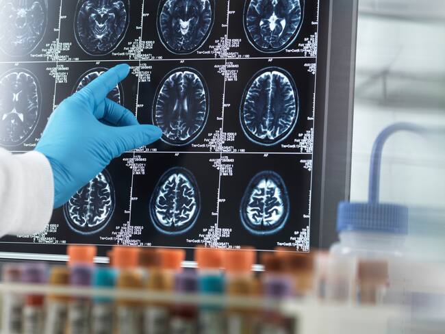 La soledad es uno de los mayores riesgos para sufrir de demencia, según experto