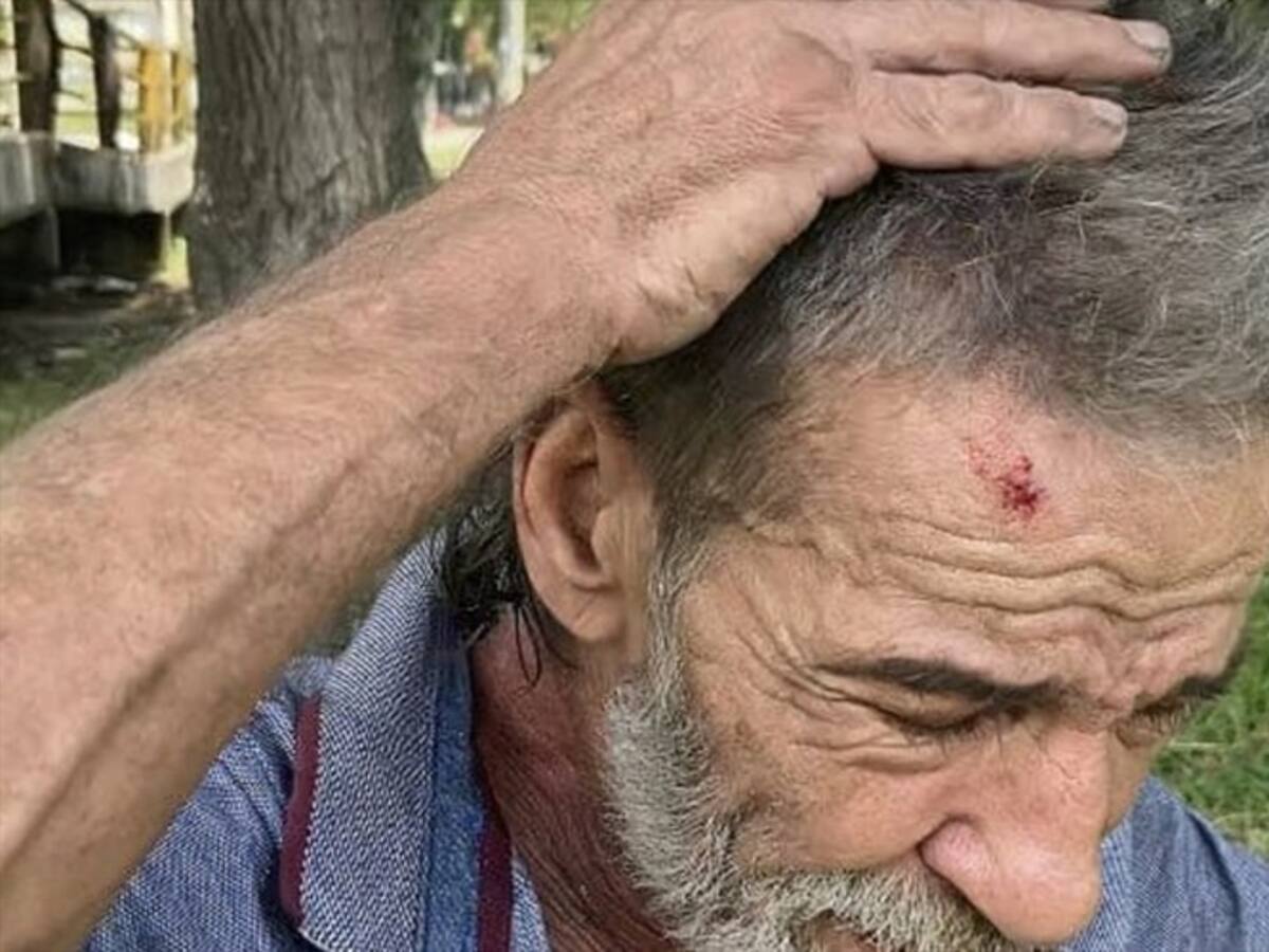 Investigan presunta agresión de policías a un habitante de calle en Cali