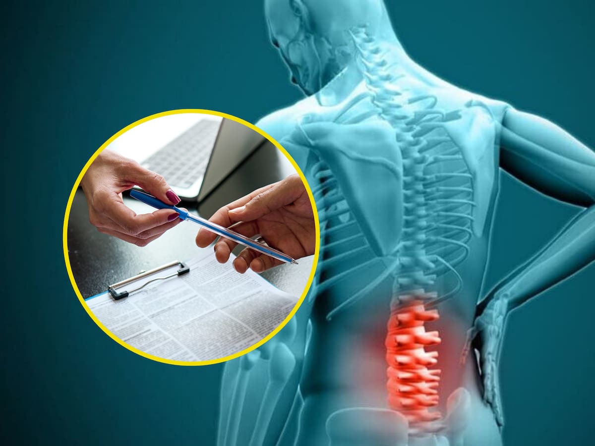 ¿Cómo solicitar una incapacidad permanente por hernia discal? Proceso y casos que aplican