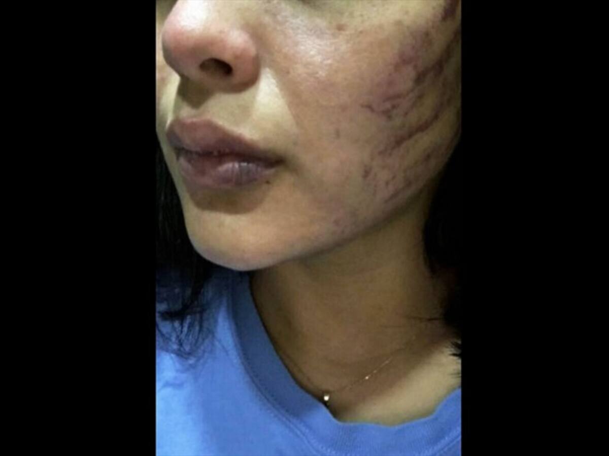 Mujer denuncia agresión por parte de su pareja en Barranquilla