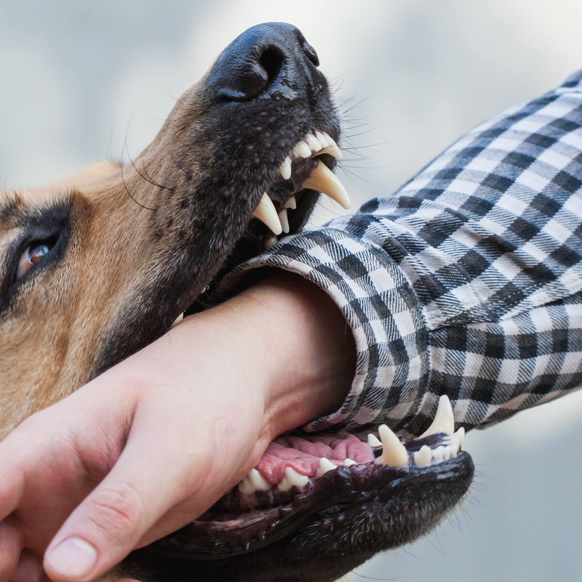 Un hombre resultó gravemente herido tras el ataque de sus perros en Bogotá