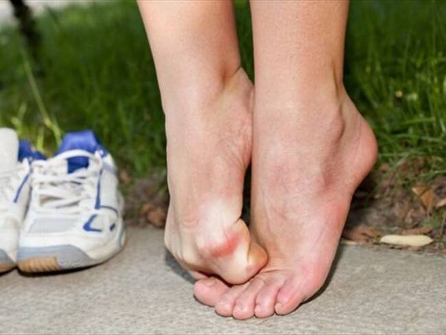 La formación de un callo puede ser, en muchos casos, una señal de alerta para detenerse y ver qué estamos haciendo mal.. Foto: Imagen tomada de BBC Mundo.