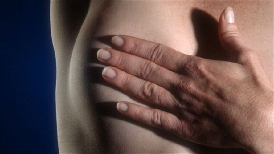 Hay varias señales que indican que se sufre de cáncer de mama. Foto: Thinkstock.
