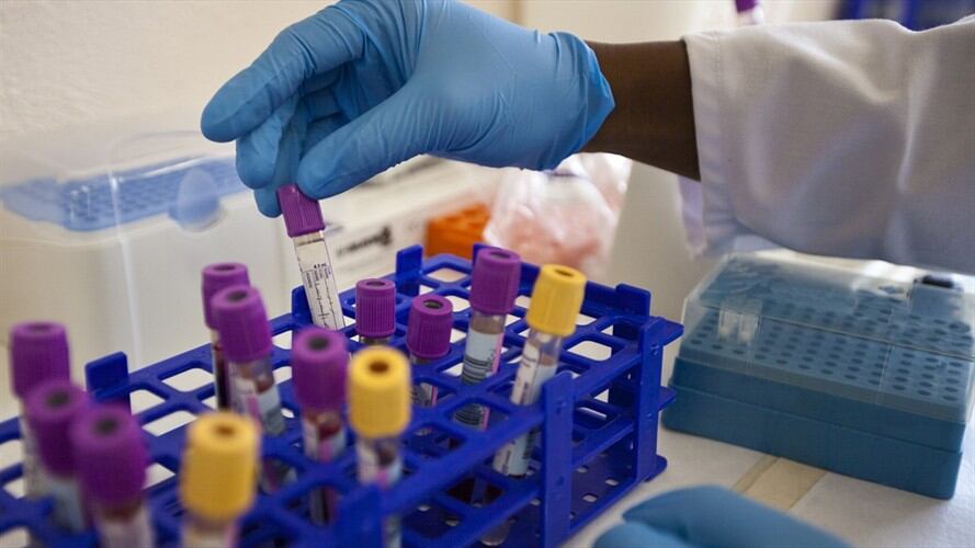 Imágen  de referencia pruebas de tratamiento contra el cáncer.. Foto: Getty Images