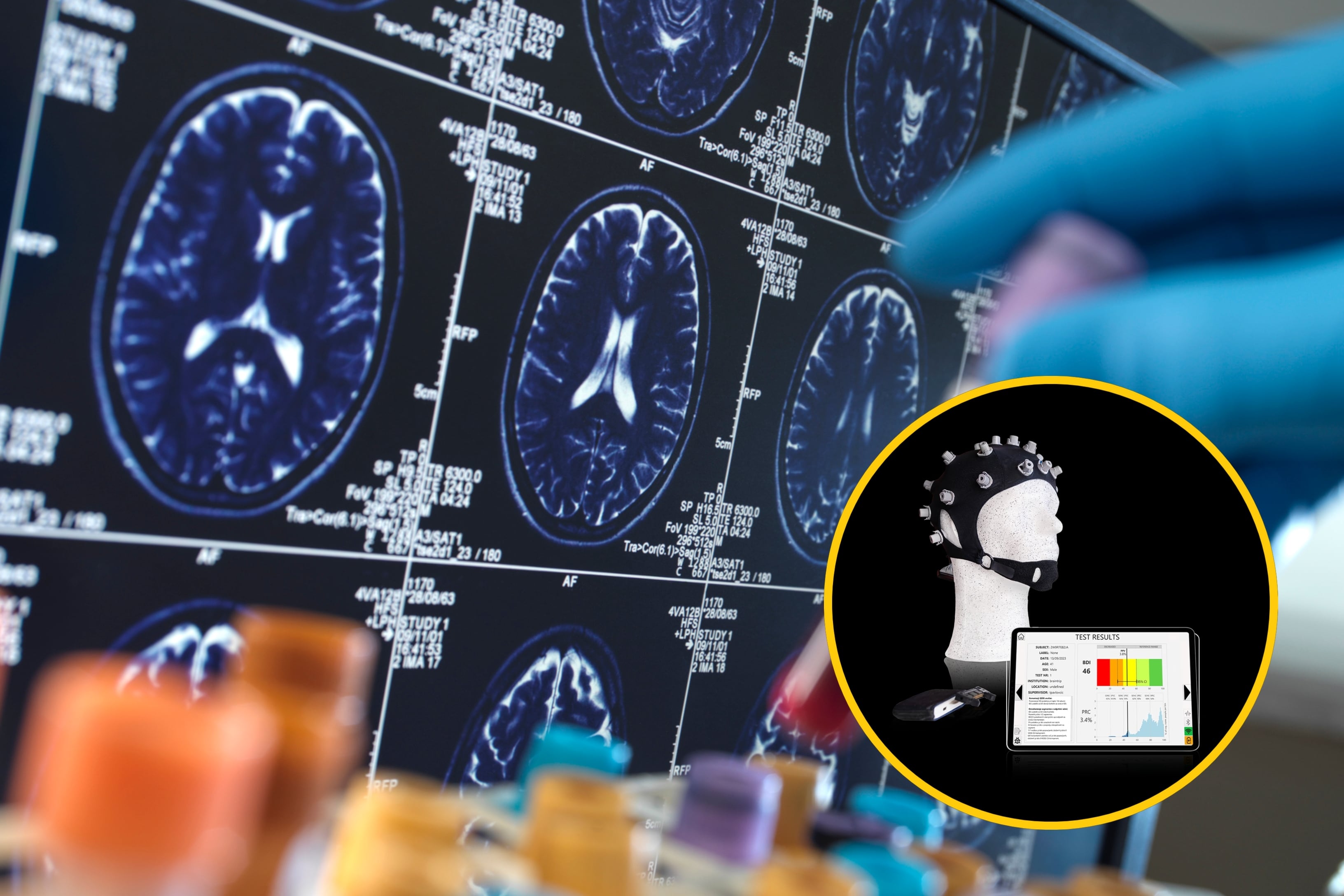 Gorro creado con IA busca detectar el Alzhéimer en su etapa inicial: así funcionaría