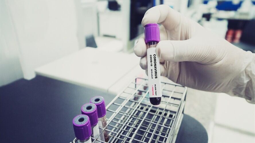 Casos de COVID-19 en Colombia. Foto: Getty Images