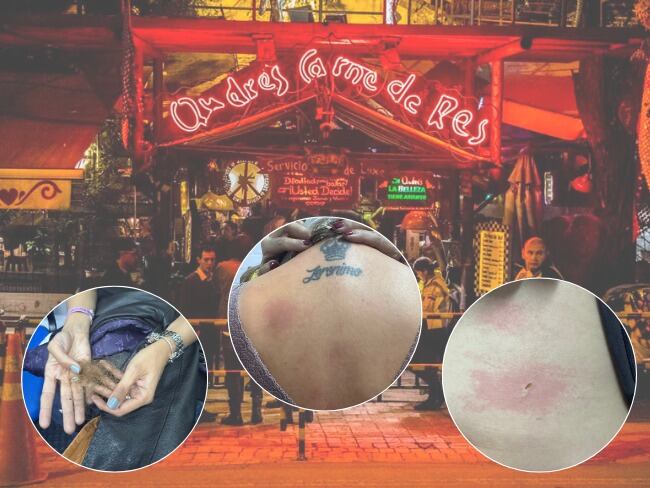 Javier, testigo del caso de Andrés DC