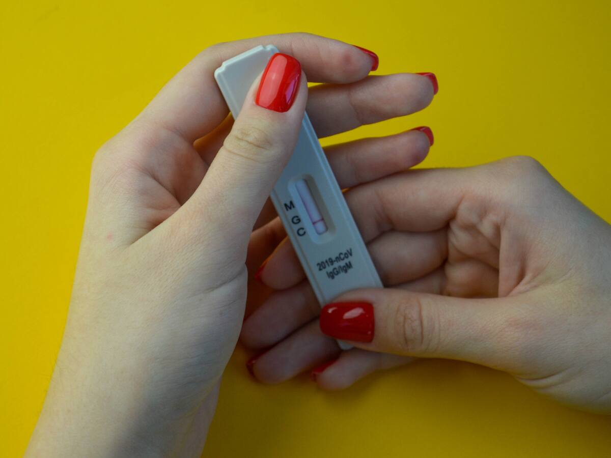 ¿Por qué las droguerías quieren comercializar las pruebas rápidas de covid-19?