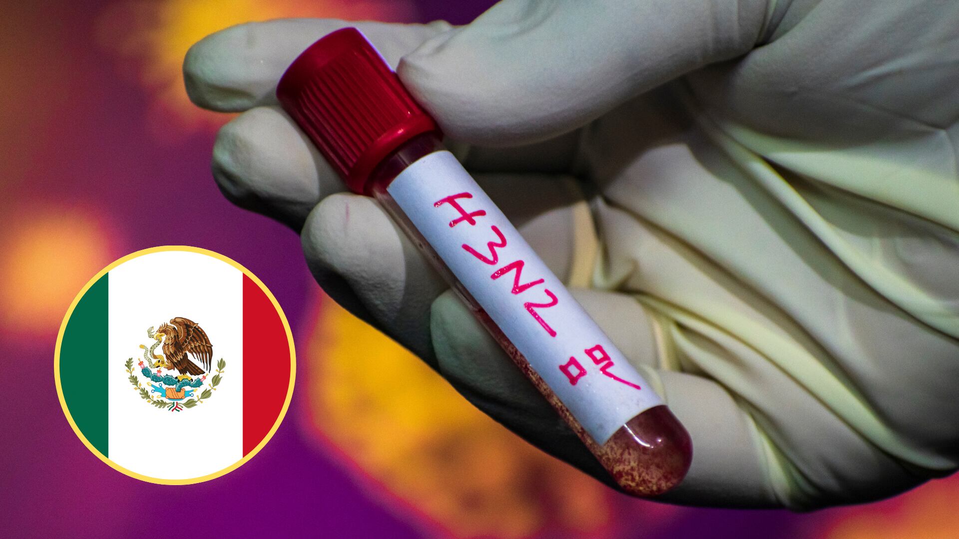 Virus H3N2, imagen de referencia - Getty Images