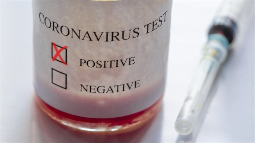 ¿Cómo funcionan las pruebas de diagnóstico del coronavirus?. Foto: Getty Images