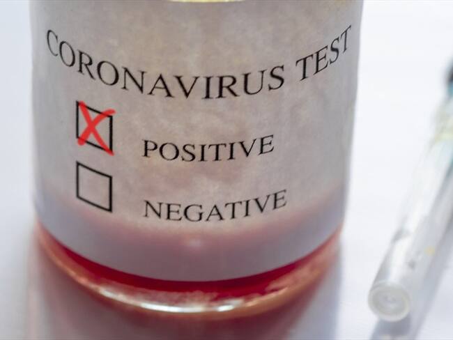 ¿Cómo funcionan las pruebas de diagnóstico del coronavirus?. Foto: Getty Images