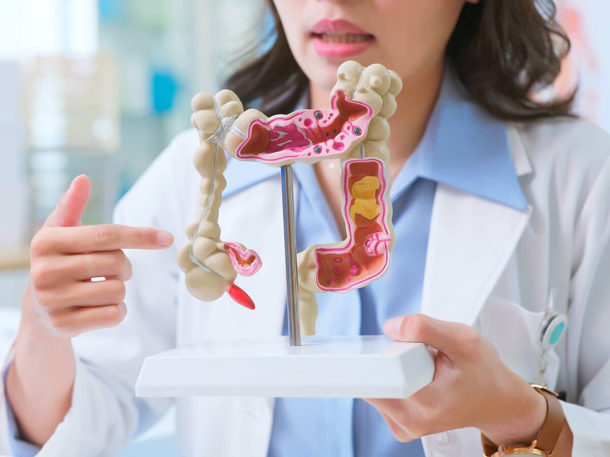 ¿Cuál es la edad adecuada para realizarse una colonoscopia? Gastroenteróloga explicó