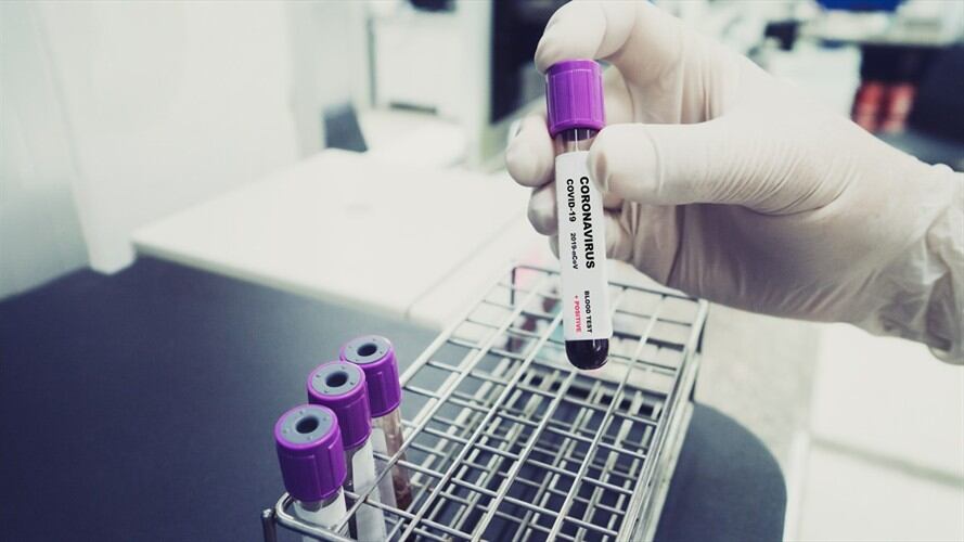 Casos de COVID-19 en Colombia. Foto: Getty Images