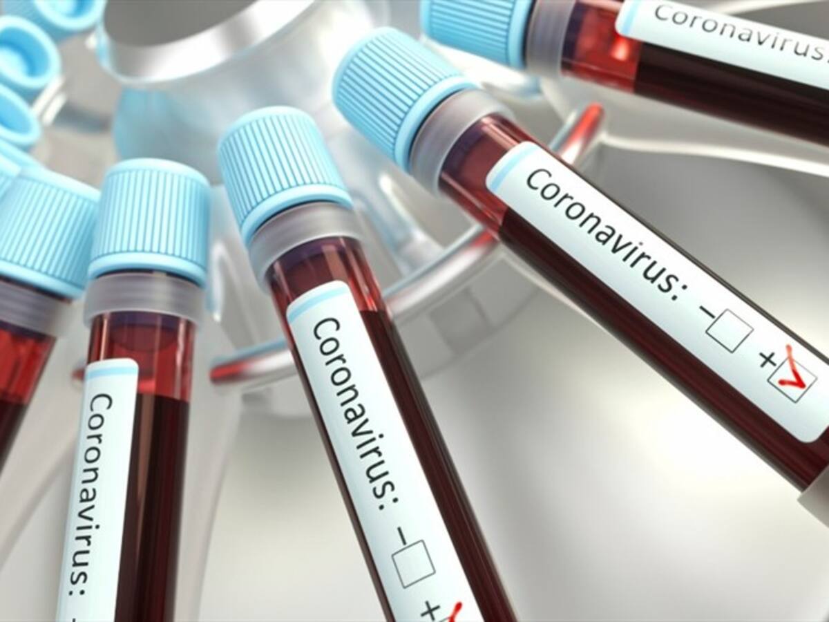 Autoridad de salud del Valle responde a denuncia sobre embalaje de pruebas de COVID-19