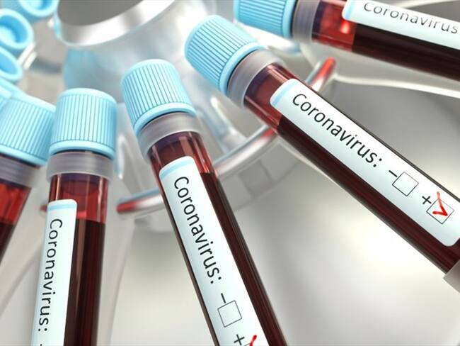 Secretaría de Salud del Valle niega que se este incumpliendo con el protocolo para embalaje y traslado de pruebas de covid - 19. Foto: Getty Images