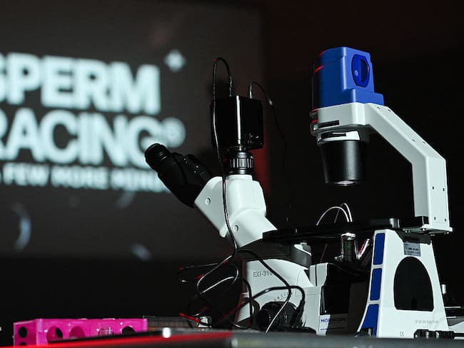 Carrera de espermatozoides busca concientizar sobre la infertilidad masculina: así funciona