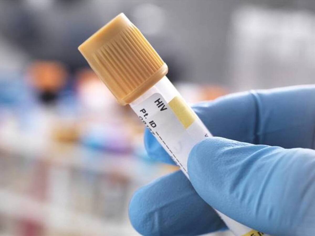 Han aumentado los fallecimiento por VIH en Risaralda en cerca de un 50%