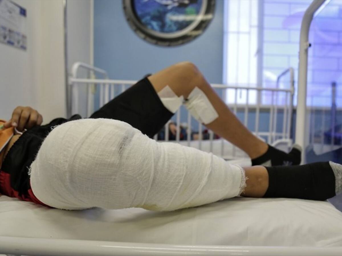 Colombia amanece con 11 nuevos casos de quemados por pólvora