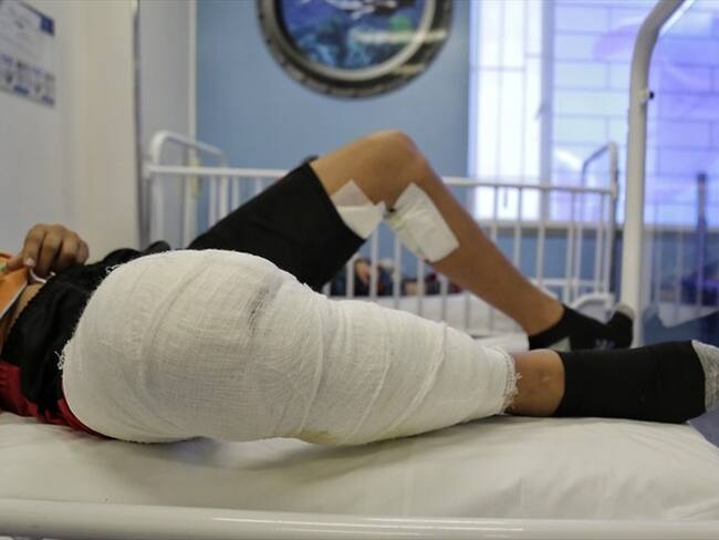 De los 45 heridos 16 son menores de edad y 29 son mayores de 18 años.. Foto: Colprensa - Álvaro Tavera