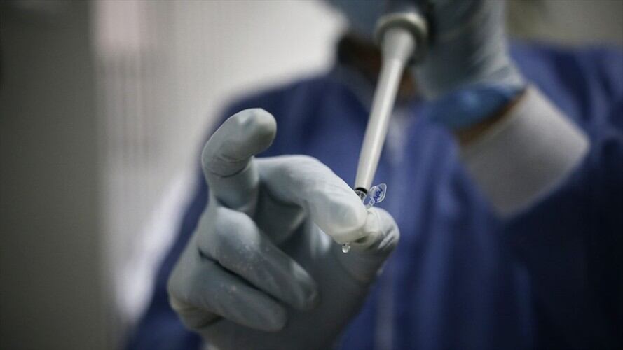 Según el ministro Fernando Ruiz, con los robots será posible procesar cerca de 2.300 pruebas al día. Foto: Colprensa