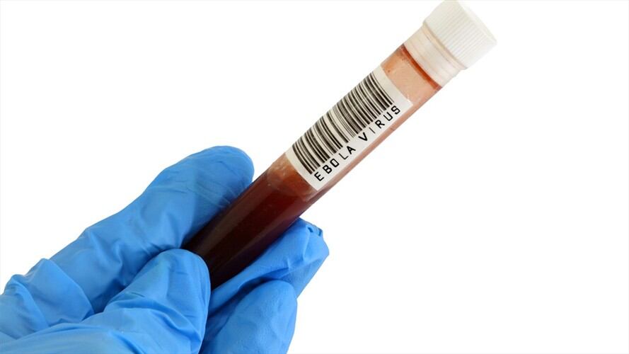 El ministro aseguró que ha se presentan cuatro muertos por la enfermedad.. Foto: Getty Images