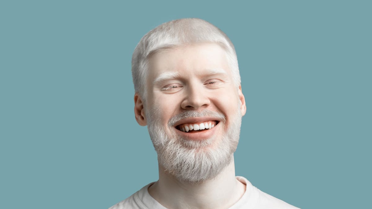 ¿Qué es el liquen escleroso? Ojo, no son hongos; experto explica