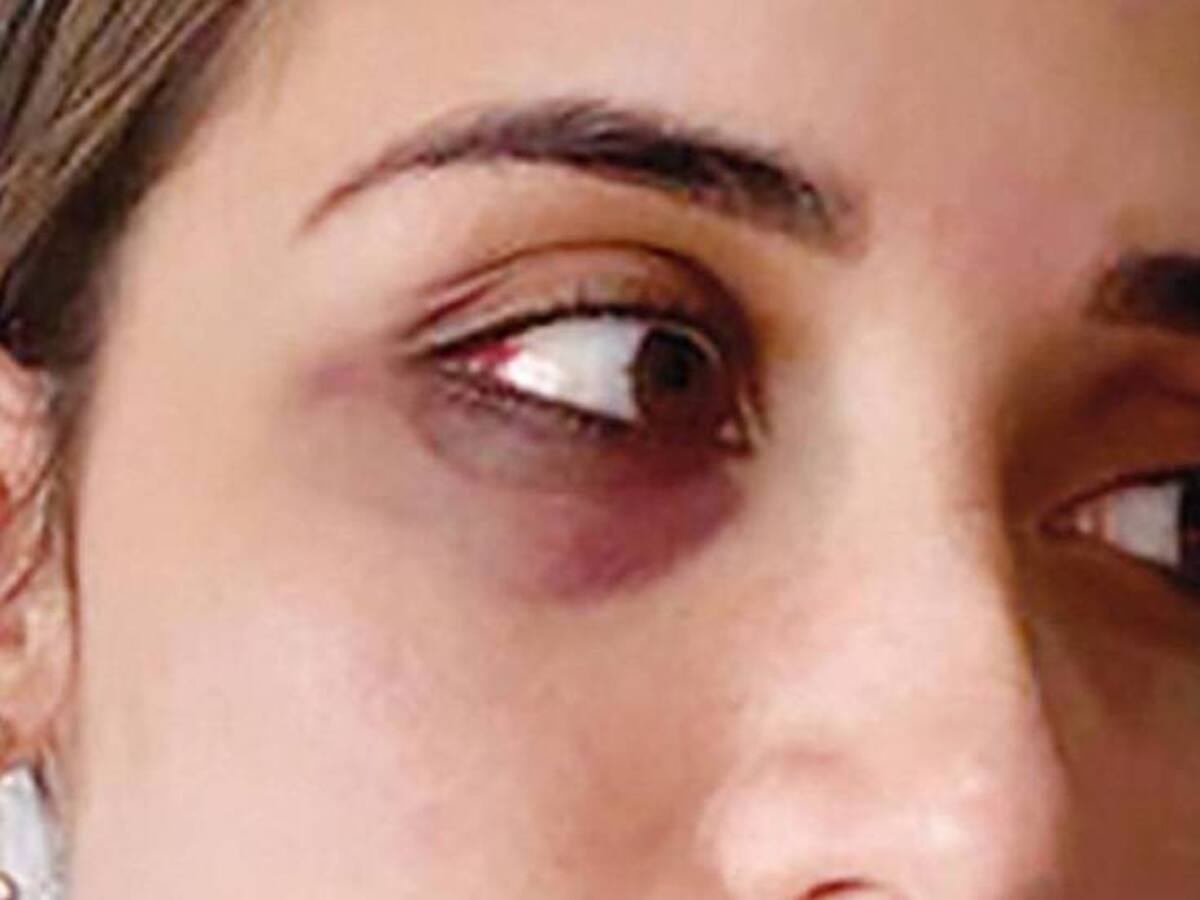 Antonio Figueredo no fue privado de su libertad tras brutal golpiza a santandereana