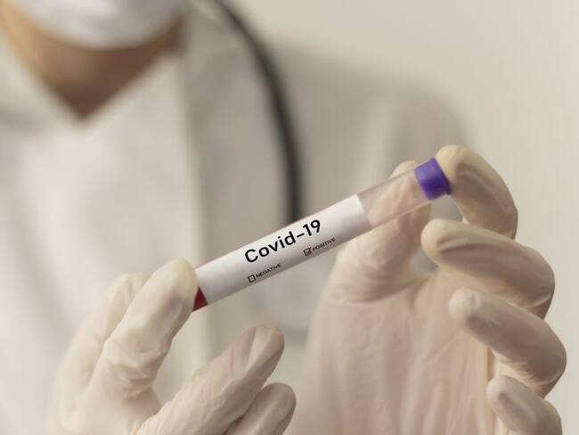 Imagen de referencia de muestra COVID-19. Foto. Getty Images