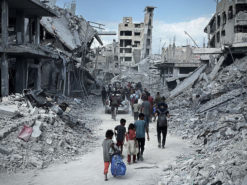 ¿Niños en Gaza podrán recuperarse de desnutrición tras acuerdo entre Israel y Hamás?