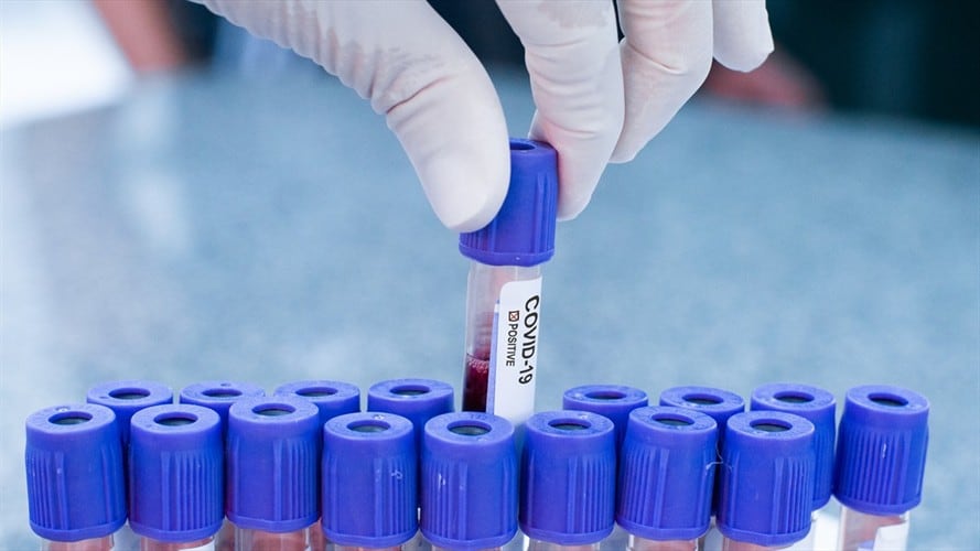 Casos de COVID-19 en Colombia. Foto: Colprensa