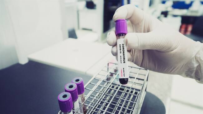 Caos de COVID-19 en Colombia. Foto: Getty Images